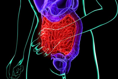 Dấu hiệu ung thư bàng quang