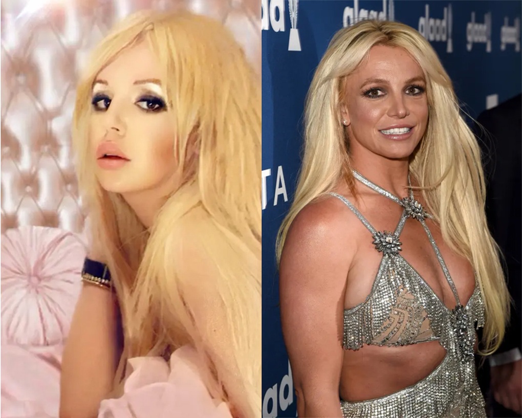 Chàng trai chi hơn 120.000 USD để phẫu thuật giống Britney Spears - 1 Chàng trai chi hơn 120.000 USD để phẫu thuật giống Britney Spears - 1