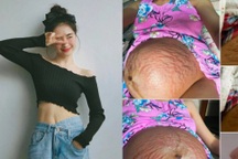 Hòa Minzy gây "sốc" khi dũng cảm công khai bụng rạn chằng chịt sau sinh