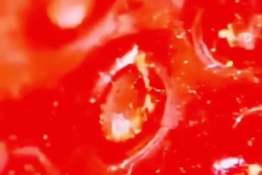 Dùng kính hiển vi soi vào quả dâu tây phát hiện thấy điều "khủng khiếp"