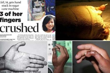 Phép màu y học: Mũi “mọc” trên trán