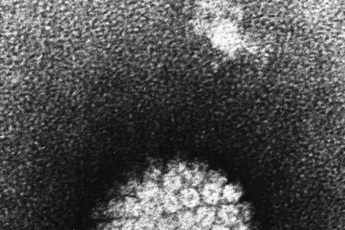 Các nhà nghiên cứu thăm dò tác động của virus HPV trên hệ thống miễn dịch