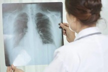 Tồn tại hàng ngàn năm, căn bệnh này vẫn khiến hơn 4.000 người chết mỗi ngày