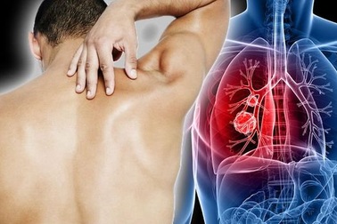 Ung thư phổi của bạn đã lan tới đâu trong cơ thể?