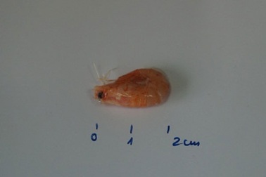 Ho dai dẳng vì... dị vật đường thở