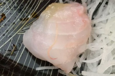 Phát hiện sinh vật "sống ngo ngoe" trong món sushi đắt đỏ tại nhà hàng