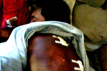 Sẽ làm nghiêm vụ một thanh niên bị “hành hình” dã man