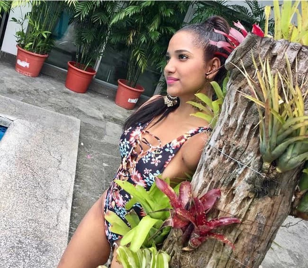 Mỹ nhân bị cưa hai tay vào chung kết Hoa hậu Ecuador 2021 - 8 Mỹ nhân bị cưa hai tay vào chung kết Hoa hậu Ecuador 2021 - 8