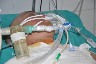 Tính mạng nguy kịch của chàng trai trẻ trong vụ cháy ở xưởng bánh kẹo tại Hoài Đức