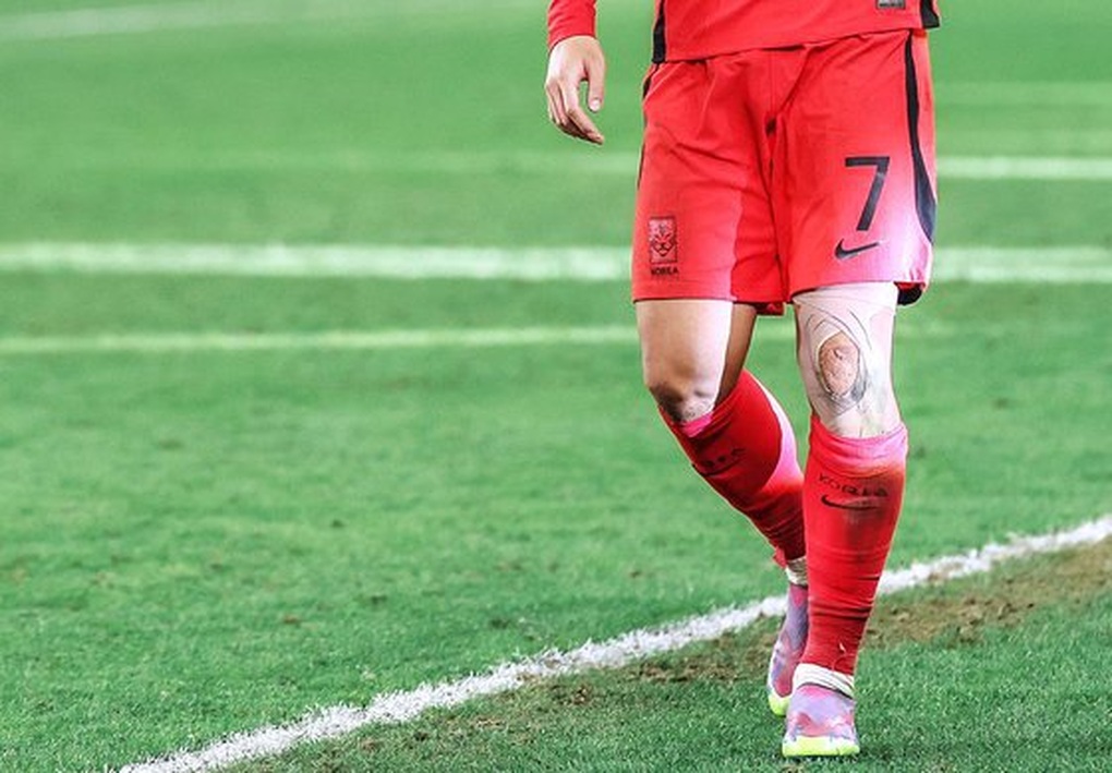 Hình ảnh quật cường của Son Heung Min khiến nhiều CĐV đau xót - 1