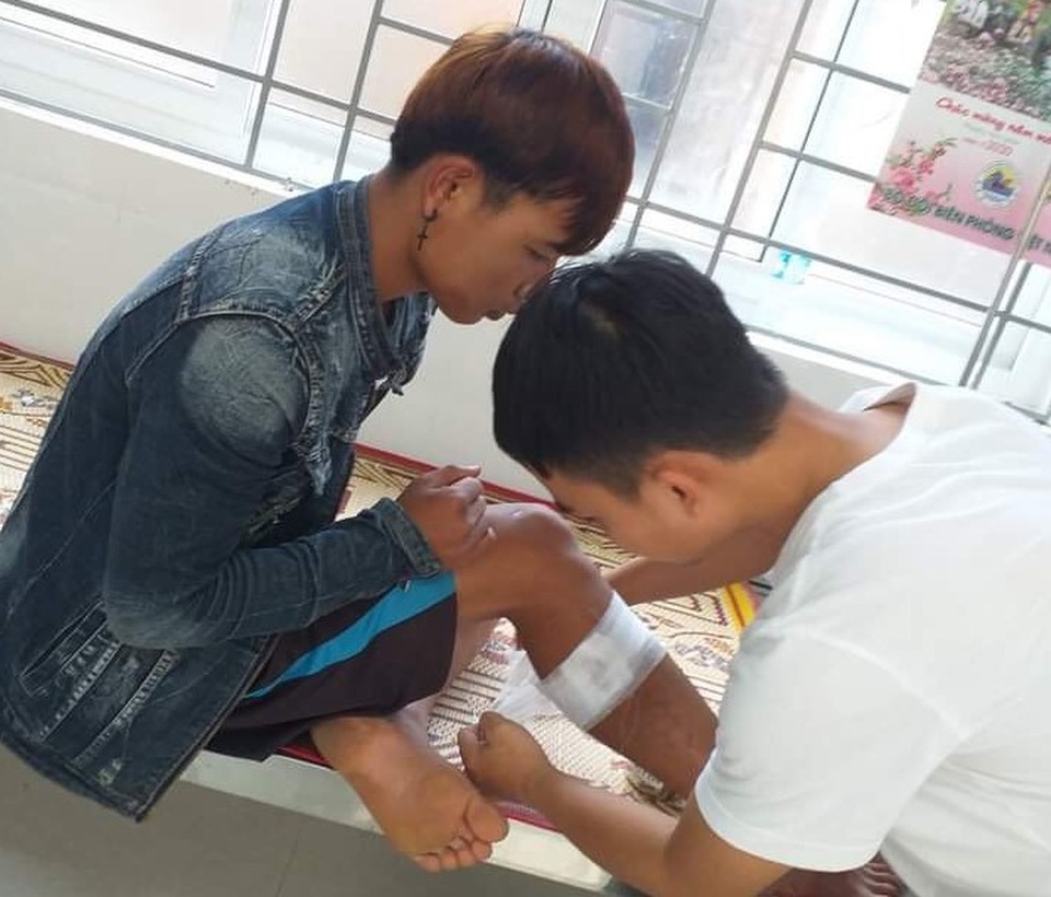 Đàn voọc gáy trắng tiếp tục lao xuống đường tấn công người - 1 Đàn voọc gáy trắng tiếp tục lao xuống đường tấn công người - 1