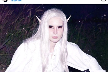 Điểm mặt những “ngôi sao” Instagram nổi tiếng nhờ ngoại hình kỳ quái