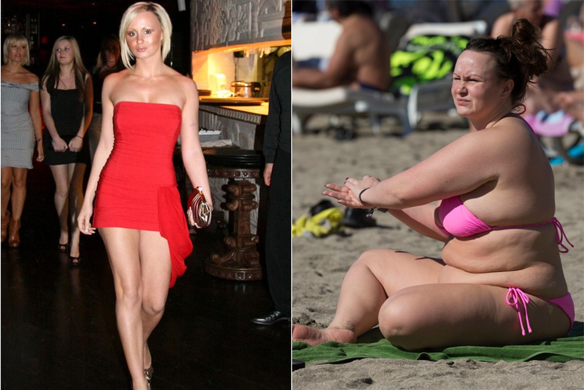 Người mẫu Chanelle Hayes gây choáng khi giảm 57 kg - 2 Người mẫu Chanelle Hayes gây choáng khi giảm 57 kg - 2