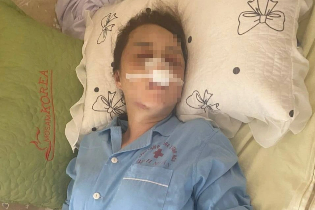 Giám định thương tật người phụ nữ bị cán bộ QLTT đánh đập vì ghen - 1 Giám định thương tật người phụ nữ bị cán bộ QLTT đánh đập vì ghen - 1