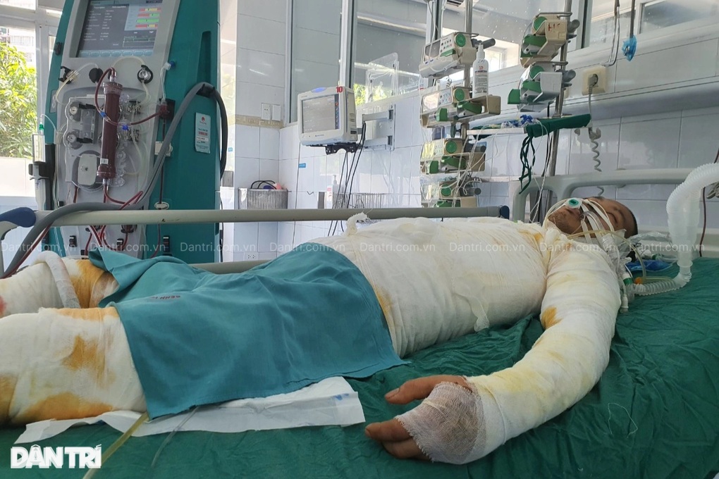 Mẹ già bán ruộng đã cùng kiệt, xin cứu con bị bỏng điện cao thế 50% cơ thể - 4 Mẹ già bán ruộng đã cùng kiệt, xin cứu con bị bỏng điện cao thế 50% cơ thể - 4