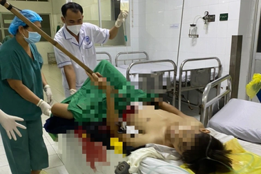 Nam thanh niên bị ngã, dao dài hơn 1m đâm thủng ruột