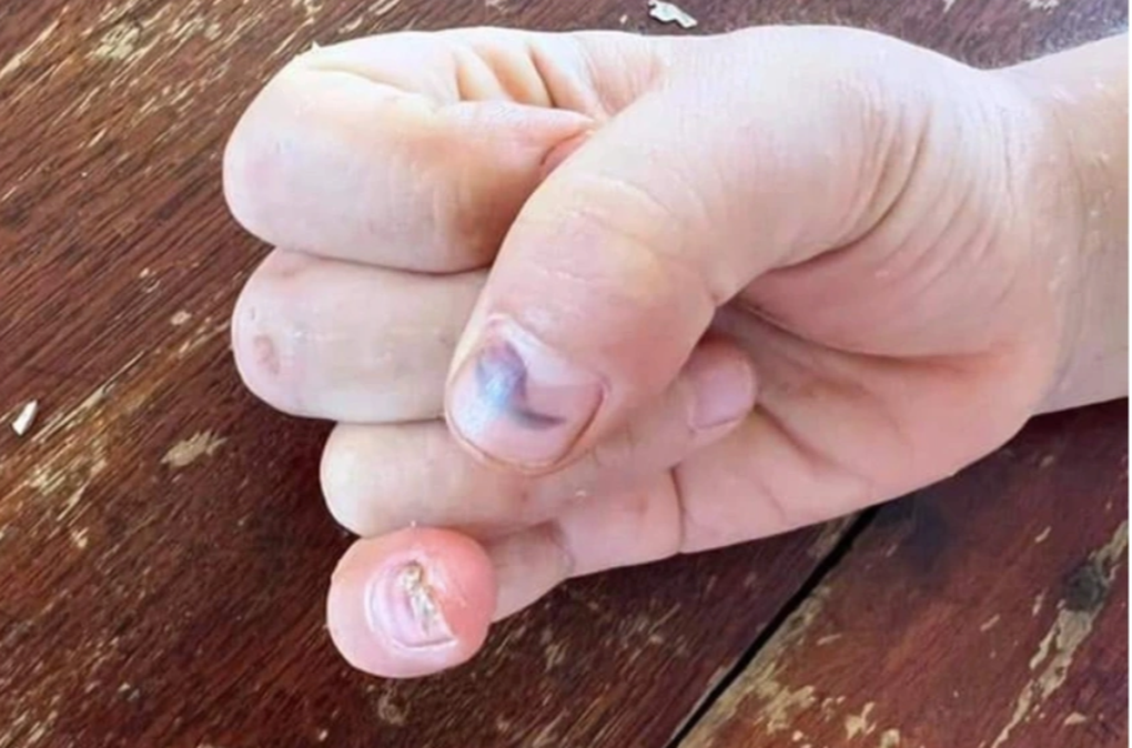Dì ghẻ đối mặt án tử hình và những đứa trẻ bị đánh đập kinh hoàng - 5 Dì ghẻ đối mặt án tử hình và những đứa trẻ bị đánh đập kinh hoàng - 5