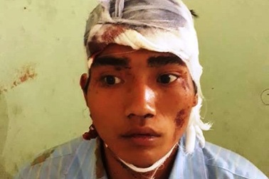 Khởi tố người chồng sát hại con gái 2 tuổi, chém vợ trọng thương