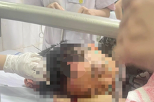 Tạm giữ 14 đối tượng trong vụ trai làng hỗn chiến ở Hải Phòng