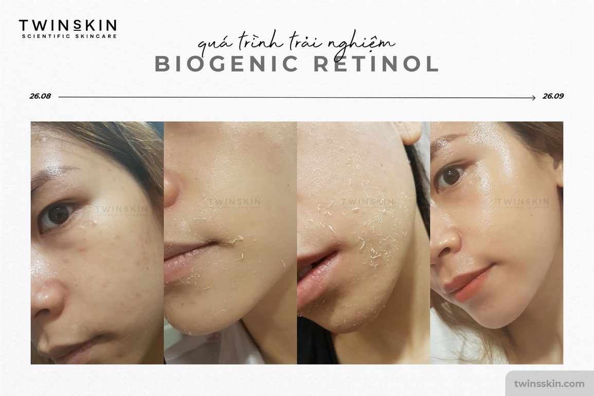Nỗi trăn trở về dược mỹ phẩm và lời hồi đáp đầy kỳ vọng từ Twins Skin - 4 Nỗi trăn trở về dược mỹ phẩm và lời hồi đáp đầy kỳ vọng từ Twins Skin - 4