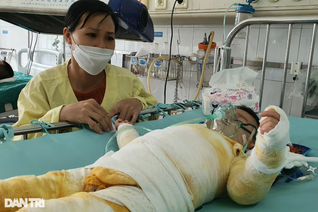 Bỏng nước sôi 66% cơ thể, bé 20 tháng tuổi nguy kịch xin cứu tính mạng - 6 Bỏng nước sôi 66% cơ thể, bé 20 tháng tuổi nguy kịch xin cứu tính mạng - 6