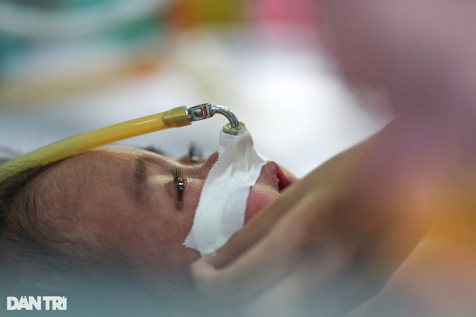 Toàn cảnh chiến dịch tiêm 1.134.200 liều vaccine chặn sởi - 4 Toàn cảnh chiến dịch tiêm 1.134.200 liều vaccine chặn sởi - 4