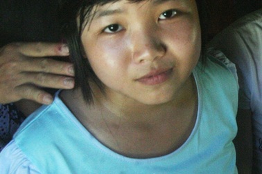 Cô bé lớp 9 bị ung thư được giải phẫu lần 2 thành công