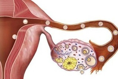 Các phương pháp phát hiện sớm ung thư buồng trứng