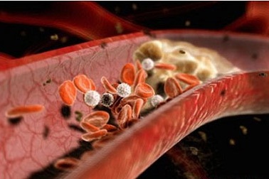 Đừng xem thường các triệu chứng "bình thường" hay gặp!