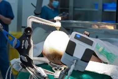 Bé 9 tuổi thoát cảnh co giật chục lần mỗi ngày nhờ kỹ thuật đặc biệt