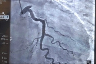 Cứu bệnh nhân người Trung Quốc nhồi máu cơ tim khi đang chơi cầu lông