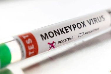 Hàn Quốc tăng cường cảnh giác sau khi phát hiện ca đậu mùa khỉ