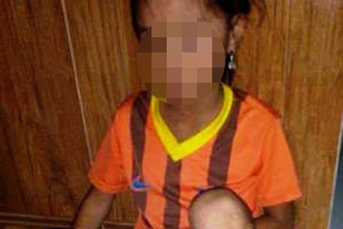 Bảo vệ bé gái 8 tuổi nghi bị bố đẻ đánh đập dã man