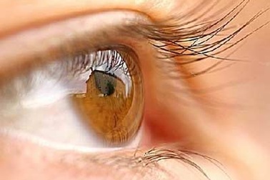 Hiện tượng vôi hóa mắt là gì?