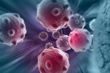 Nghiên cứu mới về việc "bỏ đói" tế bào ung thư