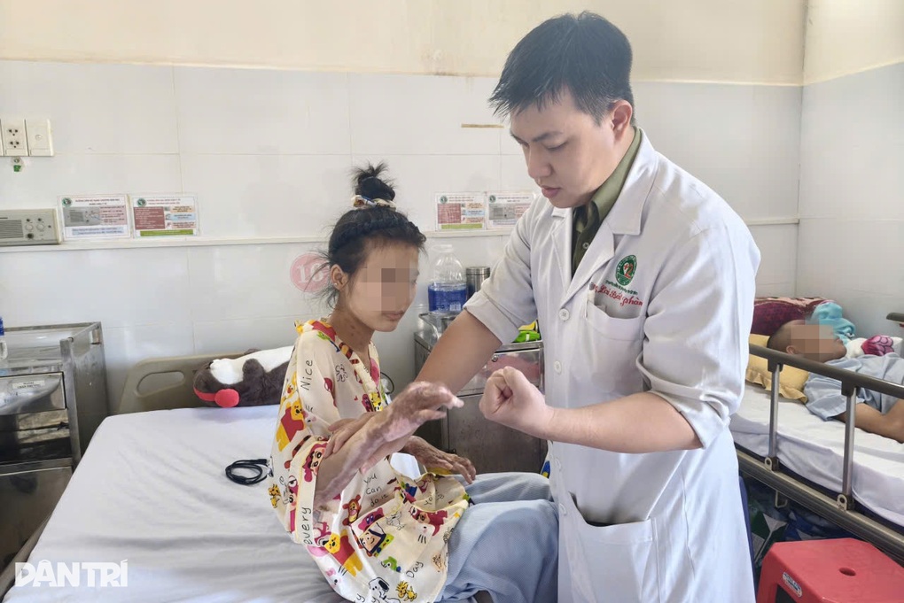 Thiếu nữ 17 tuổi bị bạn đốt keo nến làm cháy khắp người, phải mổ 15 lần - 1 Thiếu nữ 17 tuổi bị bạn đốt keo nến làm cháy khắp người, phải mổ 15 lần - 1