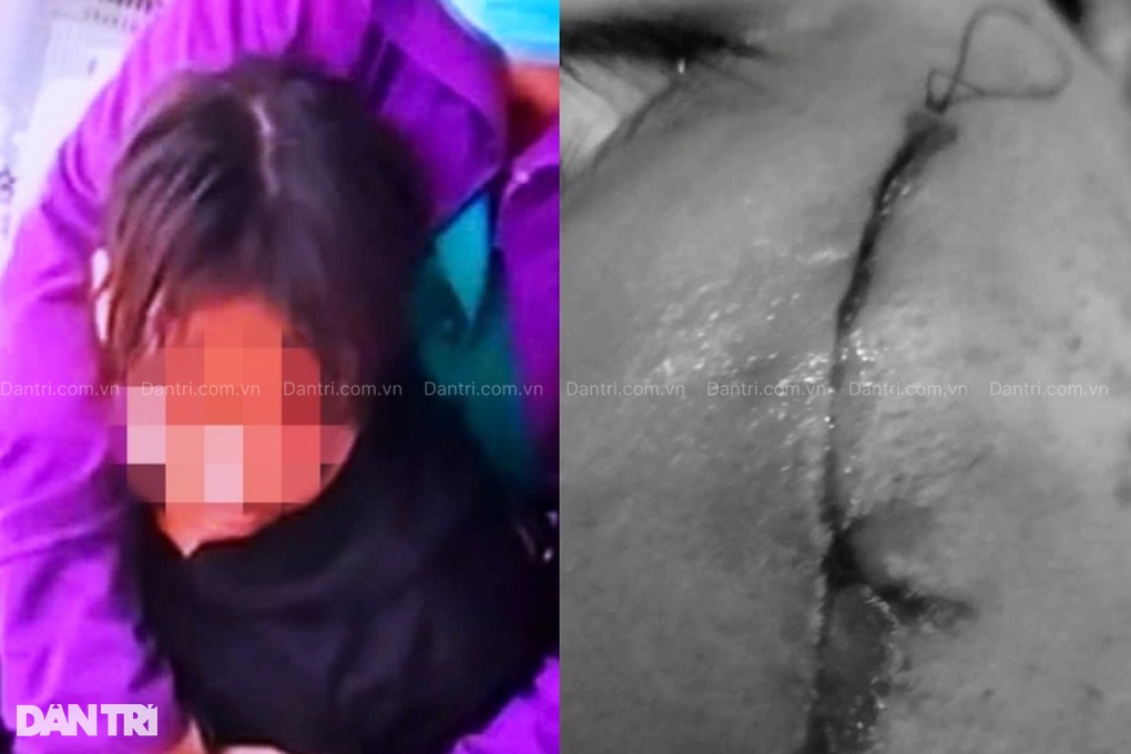 Sở Y tế TPHCM nhận nhiều phản ánh “bất thường” tại mái ấm Thiên Thần - 2 Sở Y tế TPHCM nhận nhiều phản ánh “bất thường” tại mái ấm Thiên Thần - 2