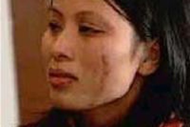 Một nữ lao động VN bị công ty môi giới hành hung