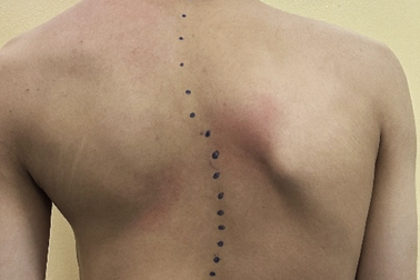 Căn bệnh hiểm khiến nam sinh càng học càng yếu khi sắp thi tốt nghiệp THPT