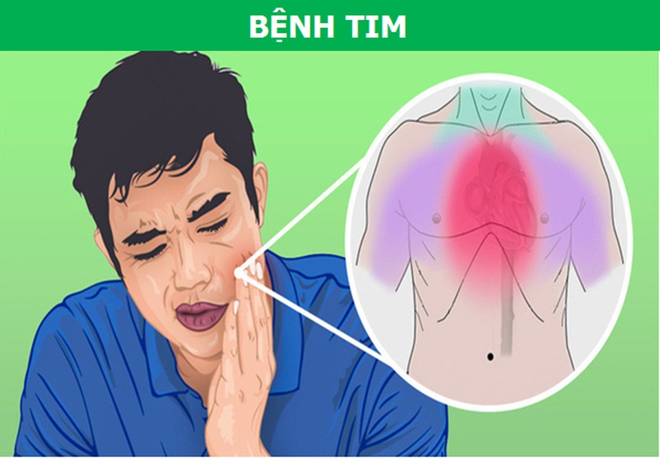 Những cơn đau kỳ lạ xuất phát từ răng miệng nói lên điều gì về sức khỏe? - 2 Những cơn đau kỳ lạ xuất phát từ răng miệng nói lên điều gì về sức khỏe? - 2