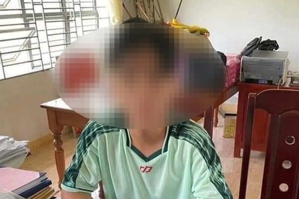 Khởi tố nam sinh nghi sát hại thầy hiệu trưởng trường THCS Hoàng Diệu - 1 Khởi tố nam sinh nghi sát hại thầy hiệu trưởng trường THCS Hoàng Diệu - 1