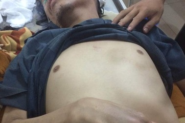 Người đàn ông nhập viện sau khi bị công an bắt tạm giam 1 ngày