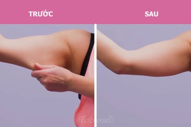 6 động tác tập tại nhà để "đánh bay" mỡ thừa, cánh tay thon gọn