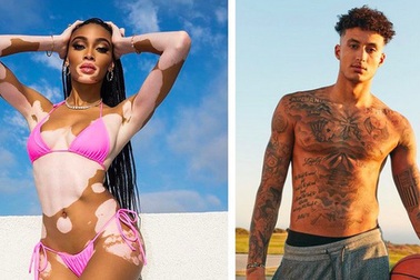 Winnie Harlow ngọt ngào chúc mừng sinh nhật bạn trai mới