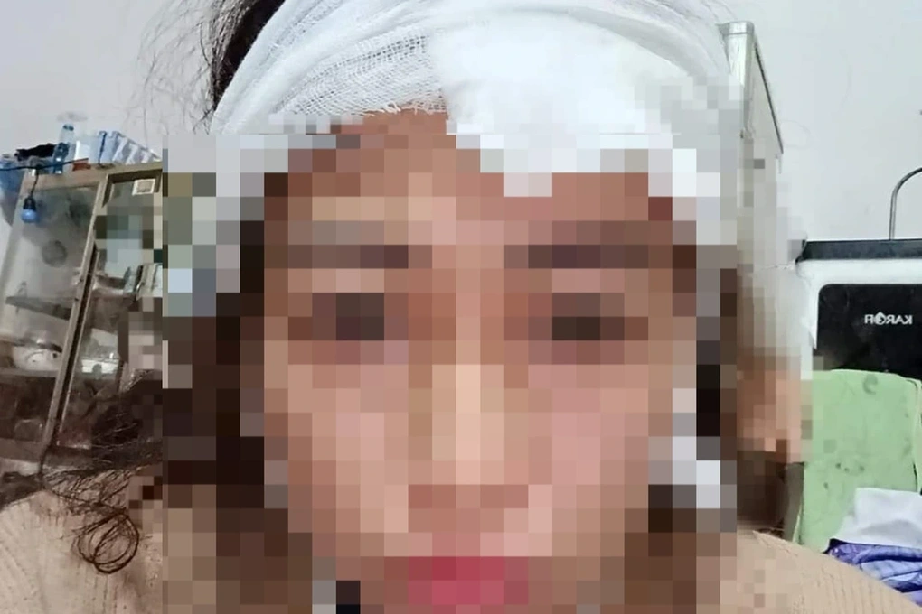 Cô gái kể bố cho mẹ ăn dao cạo, đánh thẳng vùng kín vì dám cắt tóc tém - 1 Cô gái kể bố cho mẹ ăn dao cạo, đánh thẳng vùng kín vì dám cắt tóc tém - 1