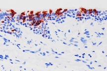 Nghiên cứu mới: Omicron sinh sôi nhanh gấp 70 lần so với Delta