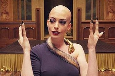 Anne Hathaway xin lỗi vì vai diễn có bàn tay khiếm khuyết gây tổn thương