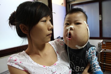 2 bệnh nhân đi cấp cứu bằng máy bay đáp ứng tốt tiến trình điều trị