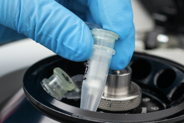 Hàng loạt người bị bệnh đường tình dục sau Tết: Khi nào cần khám giang mai?