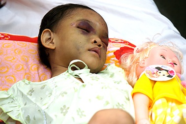 Vụ bé gái bị bạo hành: Ai được quyền nuôi dưỡng bé Ngân?